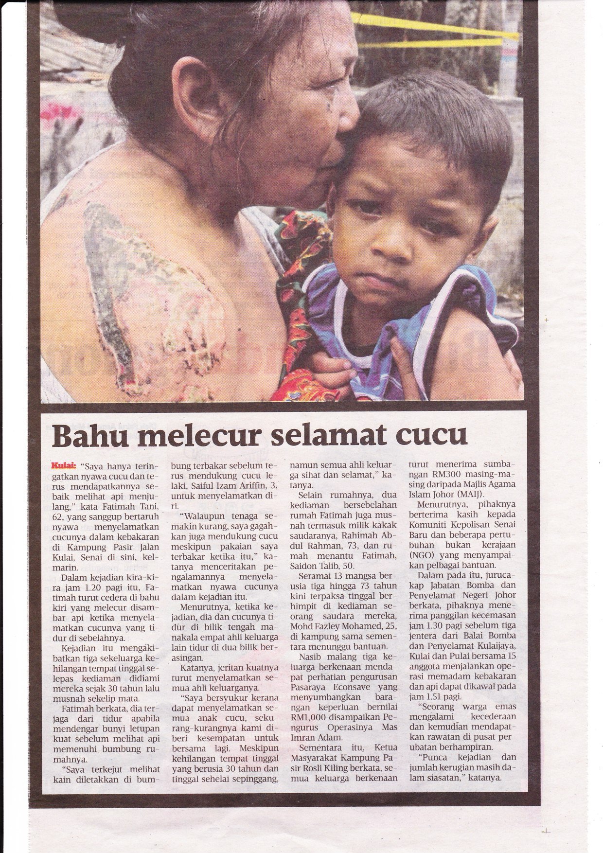 Nenek melecur untuk menyelamatkan cucu Nenek melecur untuk menyelamatkan cucu