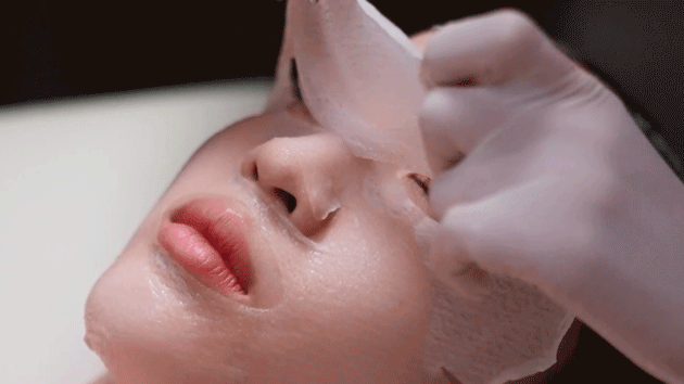 Filler injection