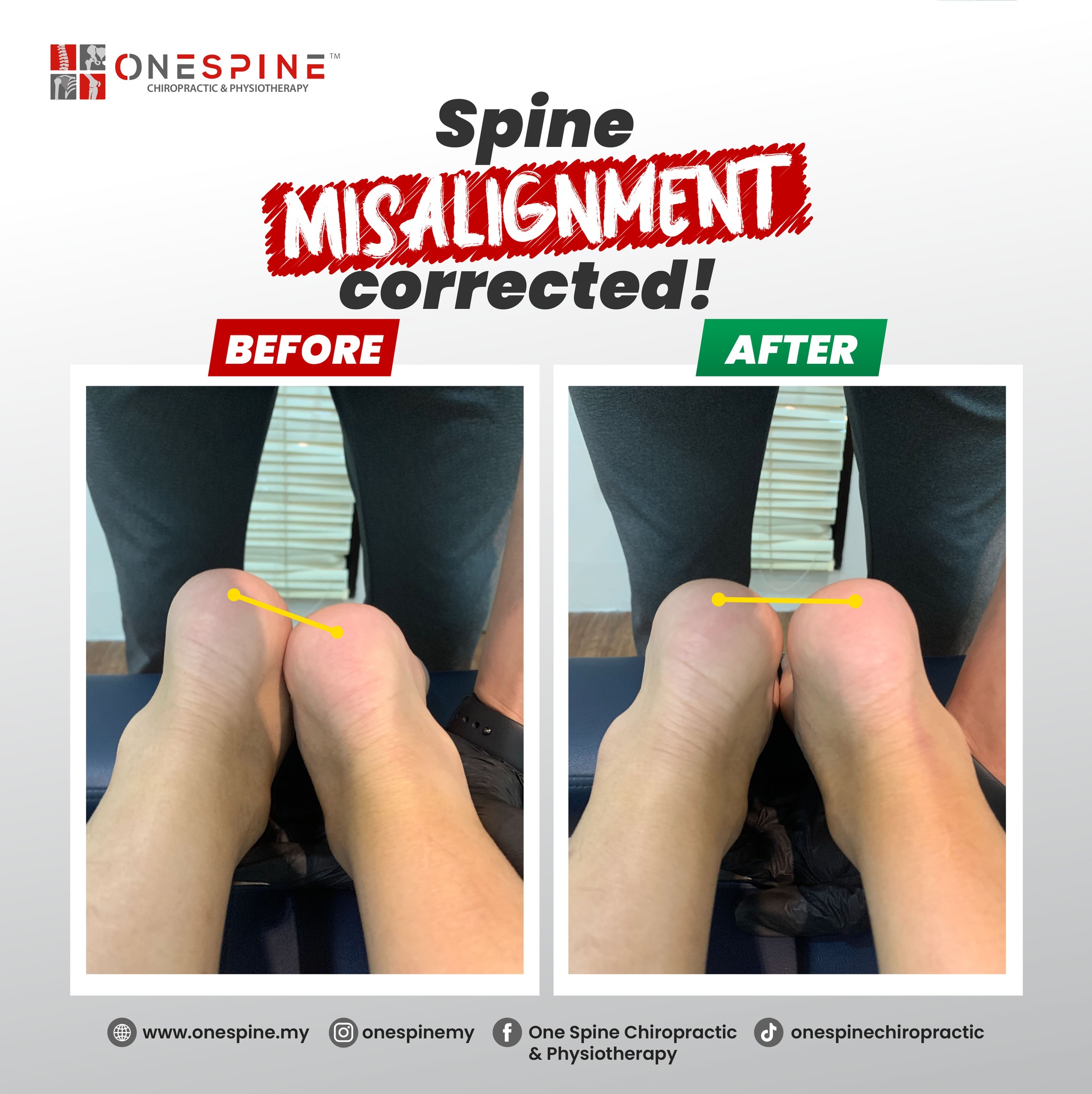Posture and movement assessment during rehabilitation