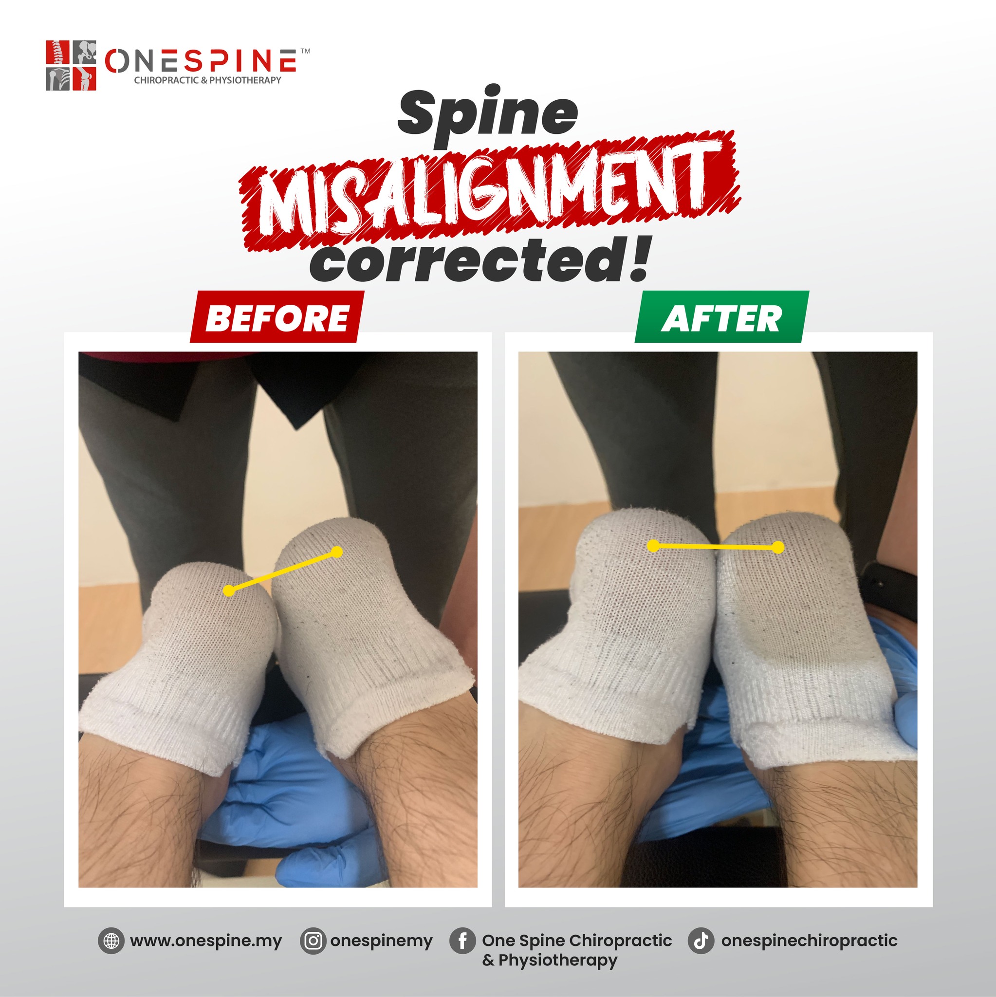 Posture and movement progress after rehabilitation support
