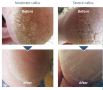 LCN UREA 25% FOOT BALM25%޸