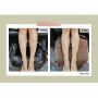 LCN UREA 10% FOOT CREAM 10%رʪˮ˪